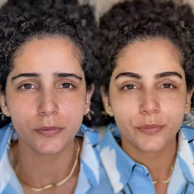 גבות בטכניקת היפראליזם, תמונת לפני ואחרי 8