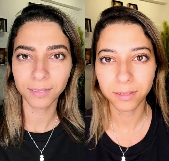 גבות במיקרובליידינג, תמונת לפני ואחרי 6